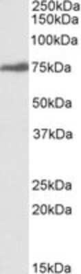 Western Blot: RSL1D1 Antibody [NBP1-51999]