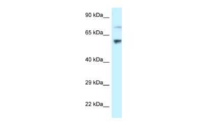 Western Blot: RSL1D1 Antibody [NBP2-88196]