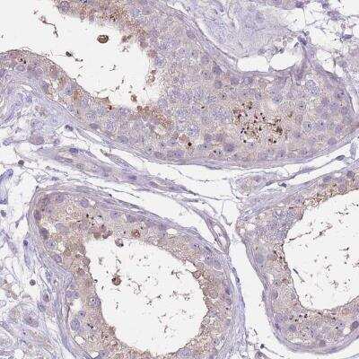 Immunohistochemistry: RSPH10B Antibody [NBP2-46768]