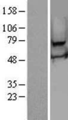 Western Blot: RSPH3 Overexpression Lysate [NBL1-15600]