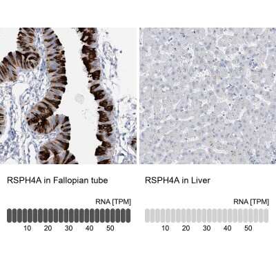 Immunohistochemistry-Paraffin: RSPH4A Antibody [NBP1-90574]