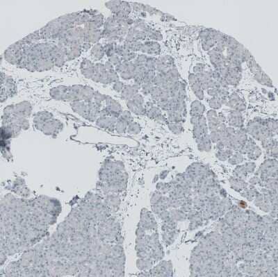 Immunohistochemistry-Paraffin: RSPH9 Antibody [NBP1-86750]