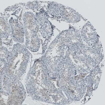 Immunohistochemistry-Paraffin: RSPH9 Antibody [NBP1-86750]