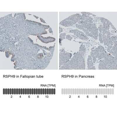 Immunohistochemistry-Paraffin: RSPH9 Antibody [NBP1-86750]