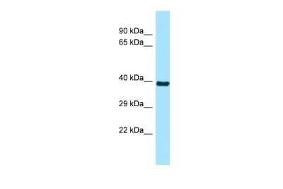 Western Blot: RSPH9 Antibody [NBP2-83480]