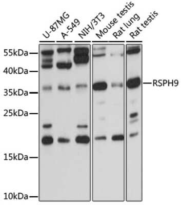 Western Blot: RSPH9 AntibodyBSA Free [NBP2-94479]