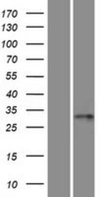 Western Blot: RSPH9 Overexpression Lysate [NBP2-05318]