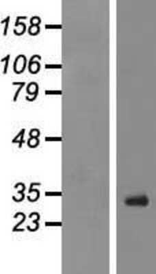 Western Blot: R-Spondin 1 Overexpression Lysate [NBP2-08561]