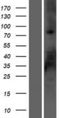 Western Blot: R-Spondin 2 Overexpression Lysate [NBL1-15601]