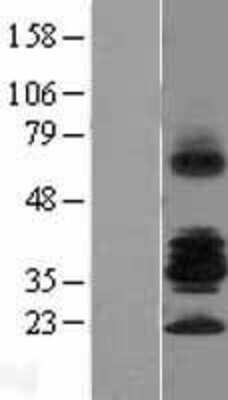 Western Blot: R-Spondin 3 Overexpression Lysate [NBL1-15602]