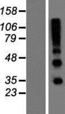 Western Blot: R-Spondin 4 Overexpression Lysate [NBP2-08600]