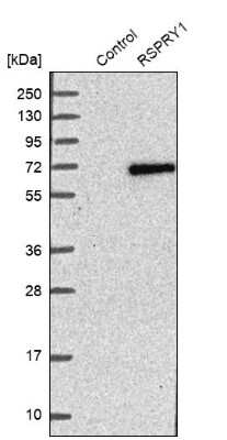 Western Blot: RSPRY1 Antibody [NBP1-92358]