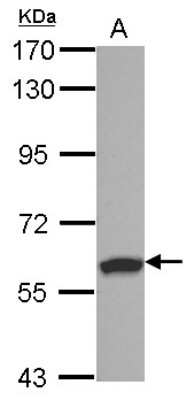 Western Blot: RSPRY1 Antibody [NBP2-20238]