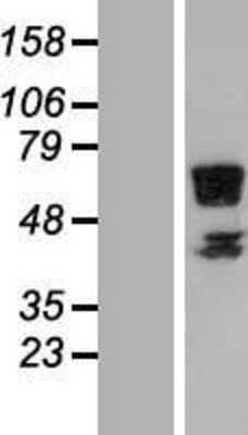 Western Blot: RSPRY1 Overexpression Lysate [NBL1-15603]