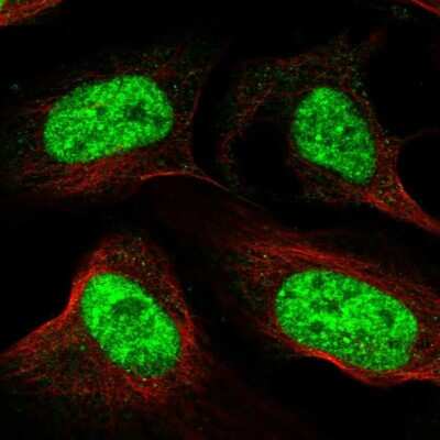 Immunocytochemistry/ Immunofluorescence: RSRC1 Antibody [NBP1-90756]