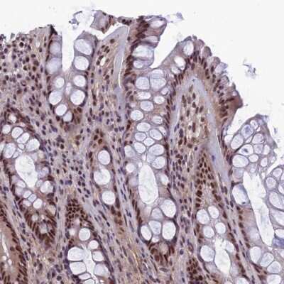 Immunohistochemistry-Paraffin: RSRC1 Antibody [NBP1-90756]