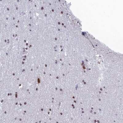 Immunohistochemistry-Paraffin: RSRC1 Antibody [NBP1-90756]