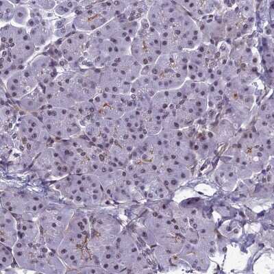 Immunohistochemistry-Paraffin: RSRC1 Antibody [NBP1-90756]