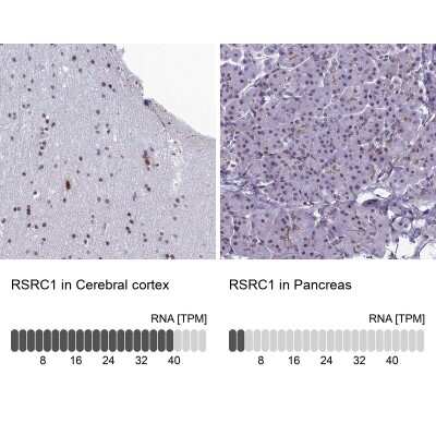 Immunohistochemistry-Paraffin: RSRC1 Antibody [NBP1-90756]
