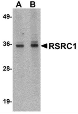 Western Blot: RSRC1 AntibodyBSA Free [NBP2-81778]