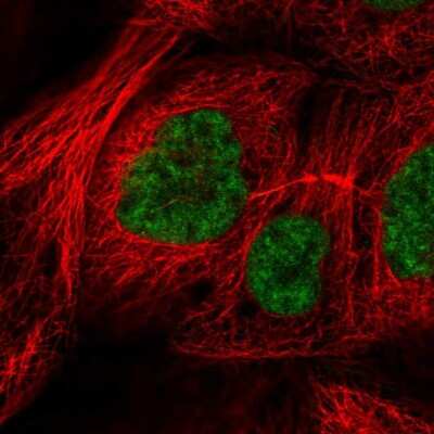 Immunocytochemistry/ Immunofluorescence: RSRC2 Antibody [NBP2-56385]