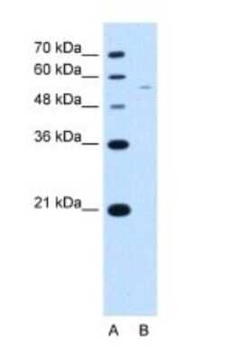 Western Blot: RSRC2 Antibody [NBP1-54332]