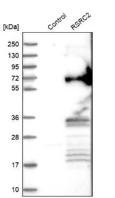 Western Blot: RSRC2 Antibody [NBP1-83787]