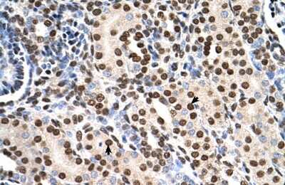 Immunohistochemistry-Paraffin: RSU1 Antibody [NBP1-54879]