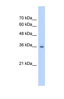 Western Blot: RSU1 Antibody [NBP1-54879]