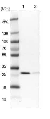 Western Blot: RSU1 Antibody [NBP1-82029]