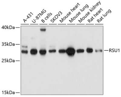 Western Blot: RSU1 AntibodyAzide and BSA Free [NBP2-94442]