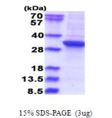 SDS-PAGE: Recombinant Human RSU1 His Protein [NBP2-51675]