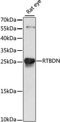 Western Blot: RTBDN AntibodyAzide and BSA Free [NBP2-93185]