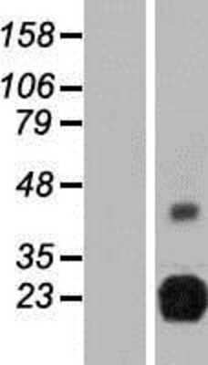 Western Blot: RTBDN Overexpression Lysate [NBP2-09278]