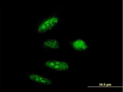 Immunocytochemistry/ Immunofluorescence: RTCD1 Antibody [H00008634-B01P]
