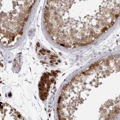 Immunohistochemistry: RTCD1 Antibody [NBP1-87112]