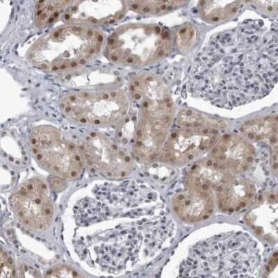 Immunohistochemistry-Paraffin: RTCD1 Antibody [NBP1-87113]