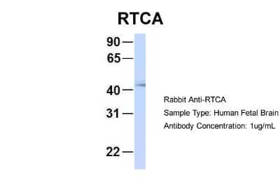 Western Blot: RTCD1 Antibody [NBP1-57245]