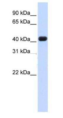 Western Blot: RTCD1 Antibody [NBP1-57245]