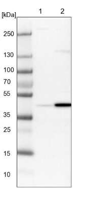 Western Blot: RTCD1 Antibody [NBP1-87113]