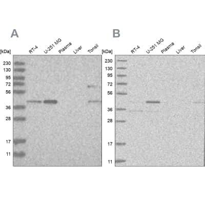 Western Blot: RTCD1 Antibody [NBP1-87113]