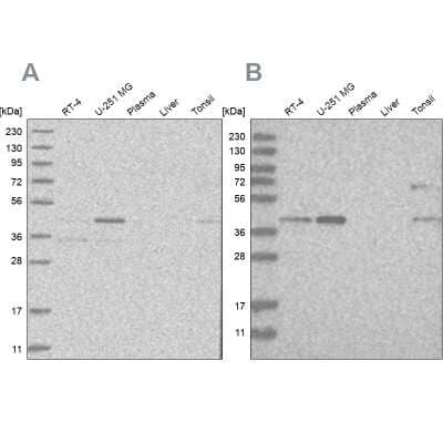 Western Blot: RTCD1 Antibody [NBP2-58714]