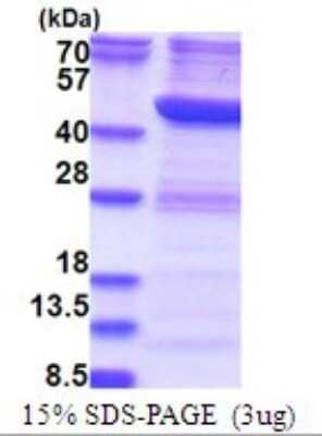 SDS-PAGE: Recombinant Human RTCD1 His Protein [NBP2-51747]