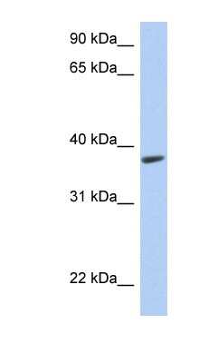 Western Blot: RTDR1 Antibody [NBP1-56596]