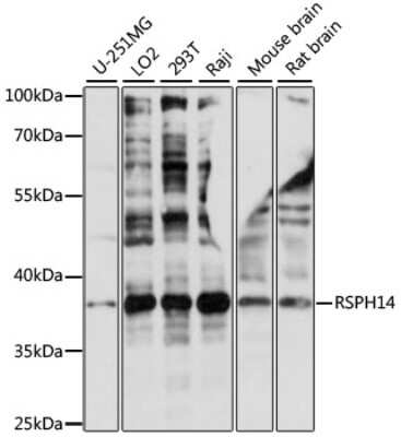 Western Blot: RTDR1 AntibodyAzide and BSA Free [NBP2-94772]