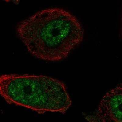 Immunocytochemistry/ Immunofluorescence: RTEL1 Antibody [NBP2-69067]