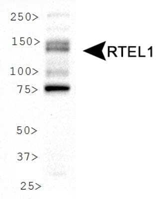 Western Blot: RTEL1 AntibodyBSA Free [NBP2-22360]