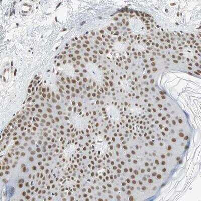 Immunohistochemistry-Paraffin: RTF1 Antibody [NBP1-83019]