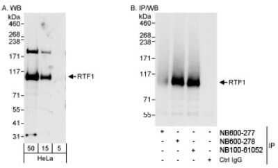 Western Blot: RTF1 Antibody [NB100-61052]