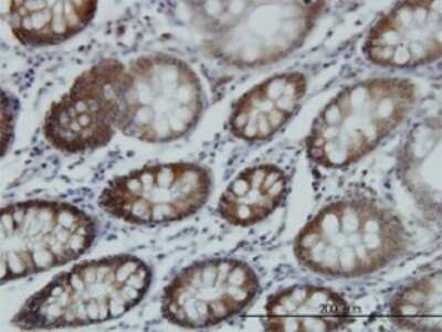Immunohistochemistry-Paraffin: RTKN Antibody (2E5) [H00006242-M01]